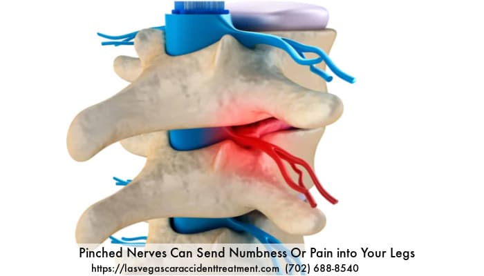 Image of Piched Nerves due To Car Crash injury Las Vegas Nevada